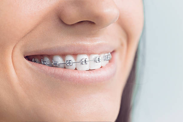 Best Wisdom Tooth Removal  in Mccamey, TX